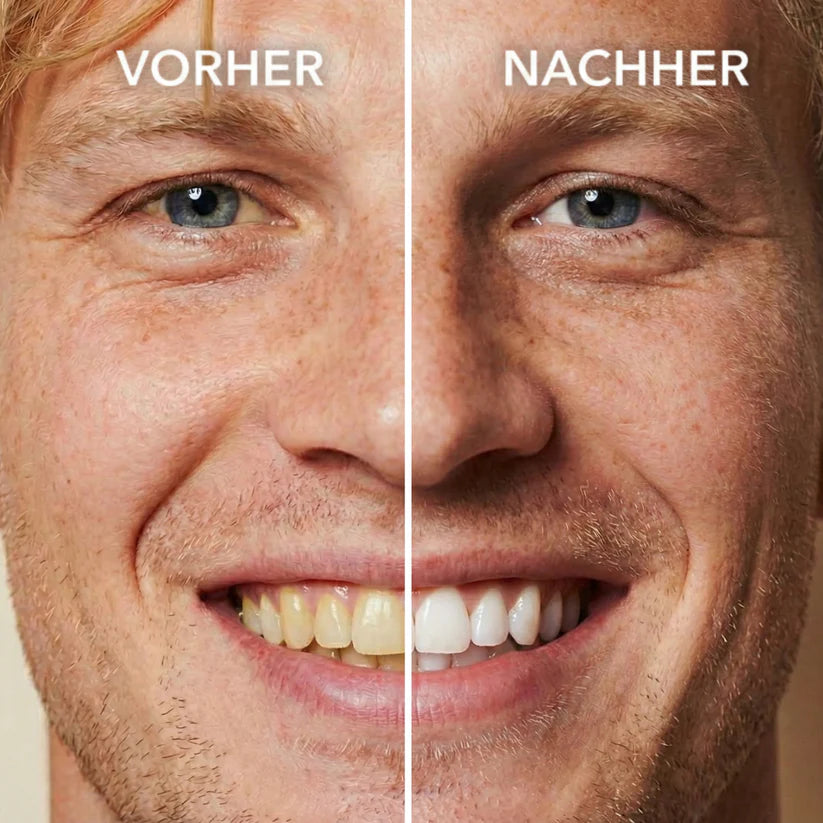 Tooth Polish - Instant Clean Smile
